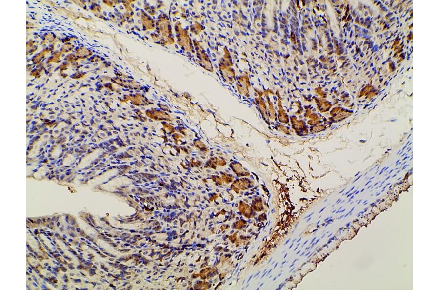 Validation Data - Anti-PI3K p85 alpha (phospho Tyr607) Antibody (A255498)