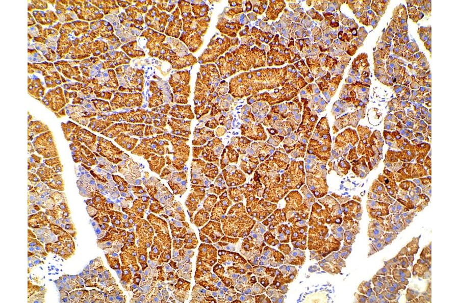 Validation Data - Anti-PI3K p85 alpha (phospho Tyr607) Antibody (A255498)