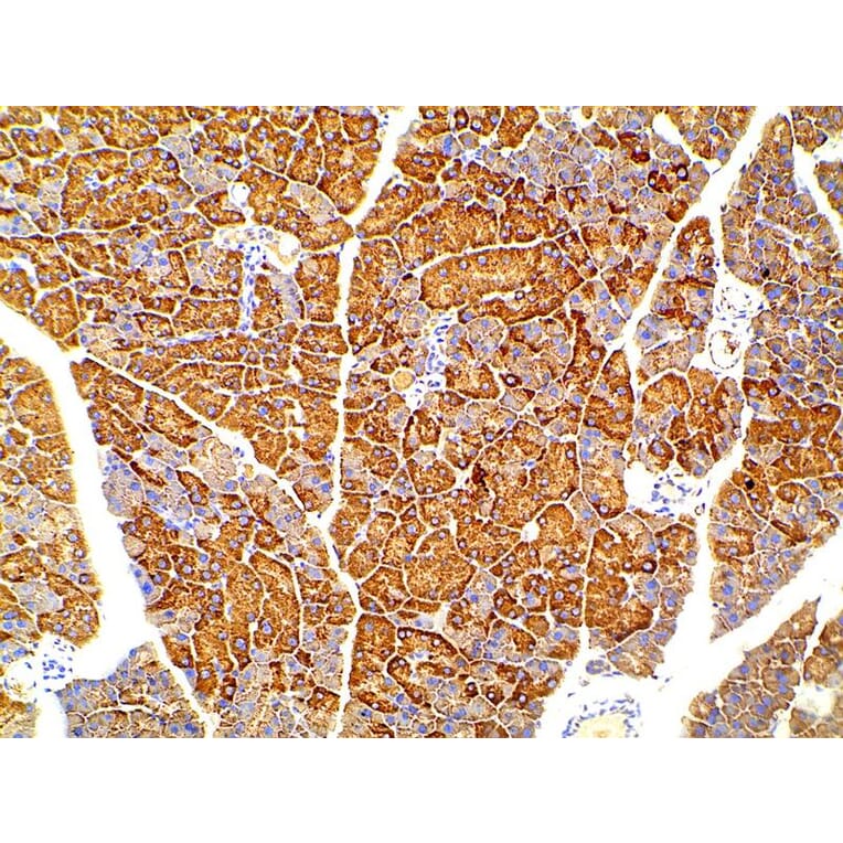 Validation Data - Anti-PI3K p85 alpha (phospho Tyr607) Antibody (A255498)