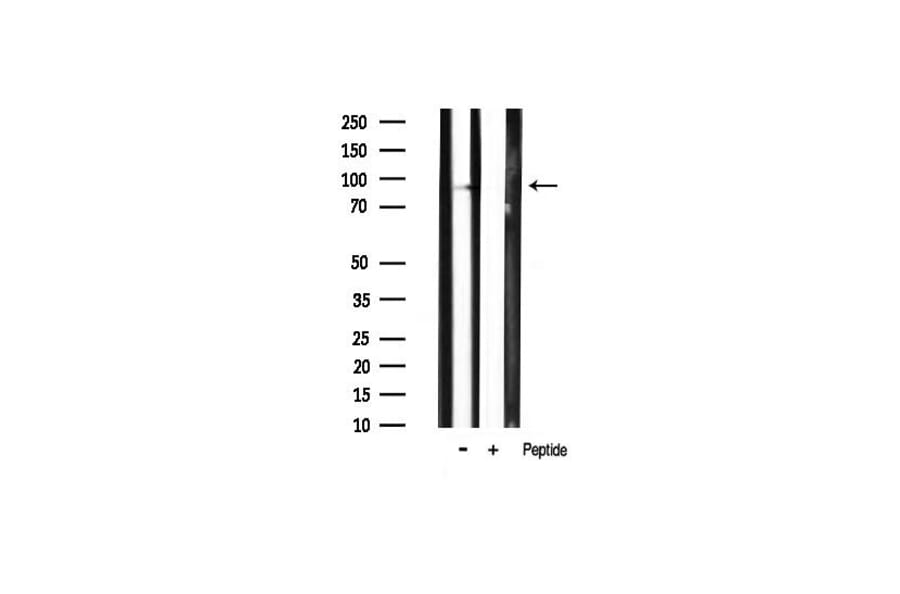 Validation Data - Anti-PI3K p85 alpha (phospho Tyr607) Antibody (A255498)