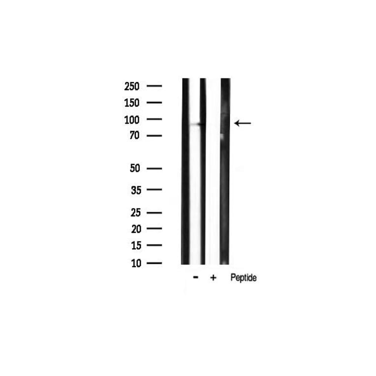 Validation Data - Anti-PI3K p85 alpha (phospho Tyr607) Antibody (A255498)