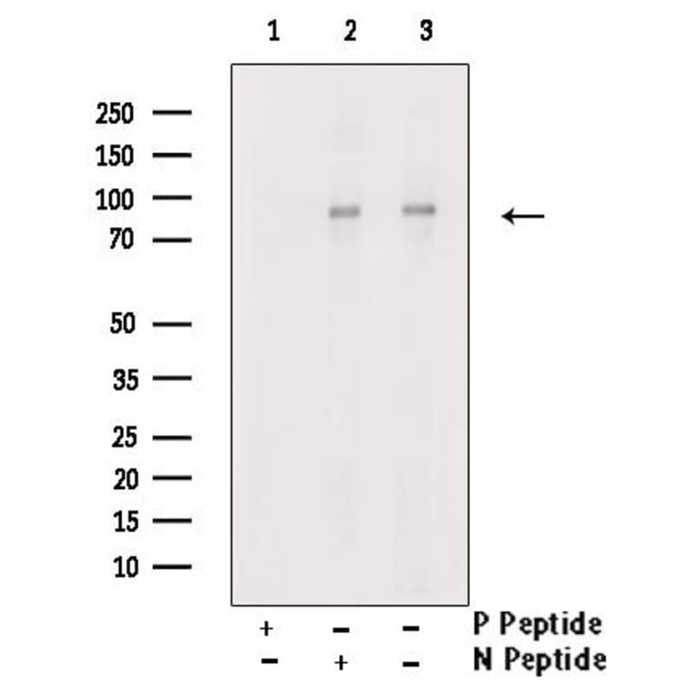Validation Data - Anti-PI3K p85 alpha (phospho Tyr607) Antibody (A255498)
