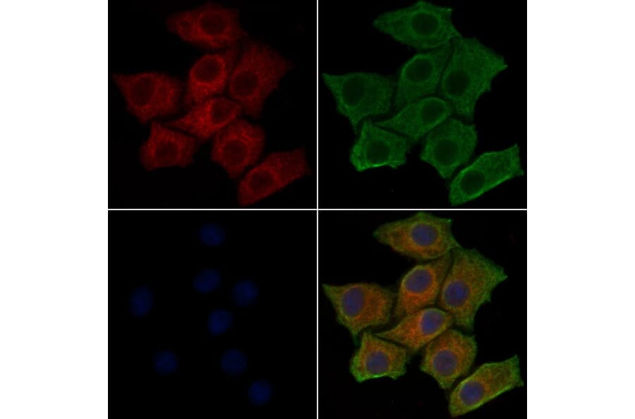 Validation Data - Anti-PI3K p85 alpha (phospho Tyr607) Antibody (A255498)