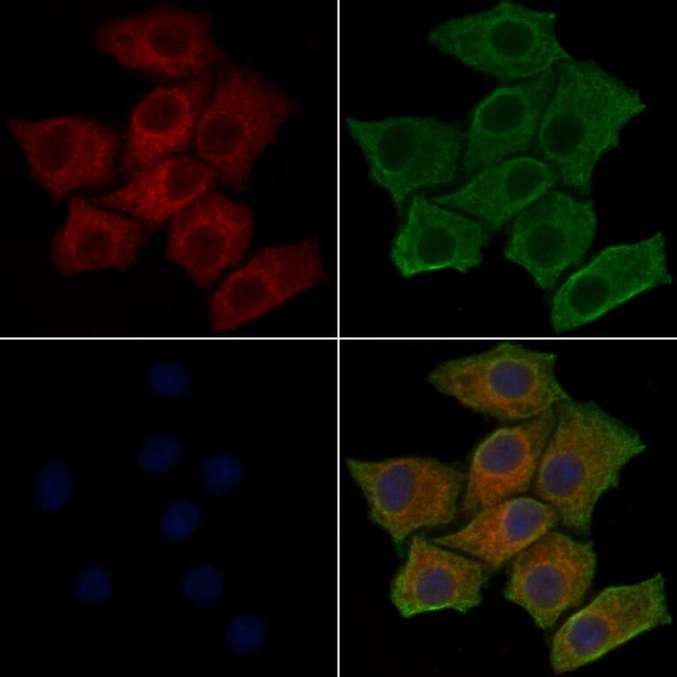 Validation Data - Anti-PI3K p85 alpha (phospho Tyr607) Antibody (A255498)