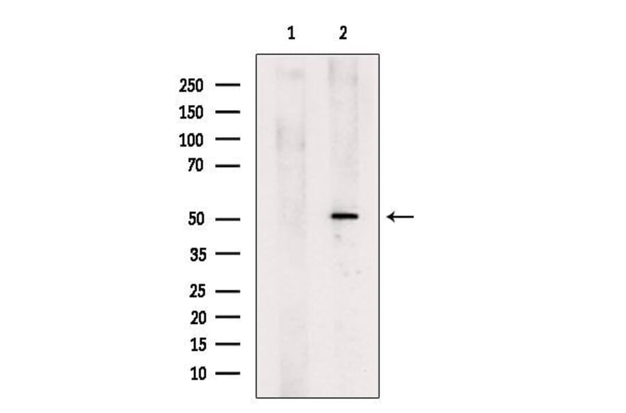 Validation Data - Anti-GSDMD Antibody (A256242)