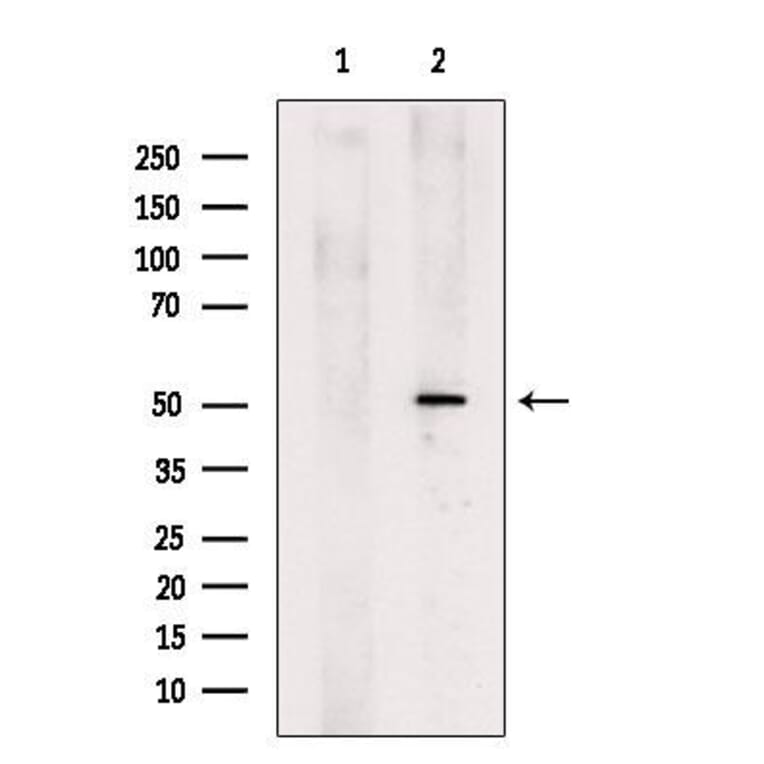 Validation Data - Anti-GSDMD Antibody (A256242)