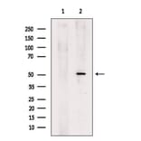 Validation Data - Anti-GSDMD Antibody (A256242)