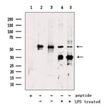 Validation Data - Anti-GSDMD Antibody (A256242)