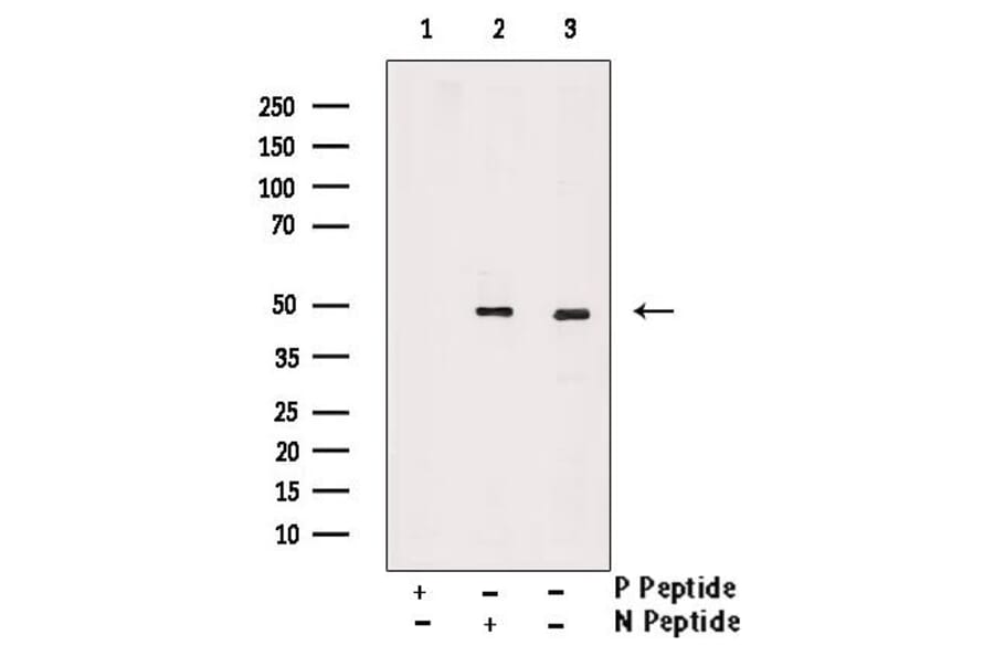 Validation Data - Anti-TAZ (phospho Ser66) Antibody (A256301)