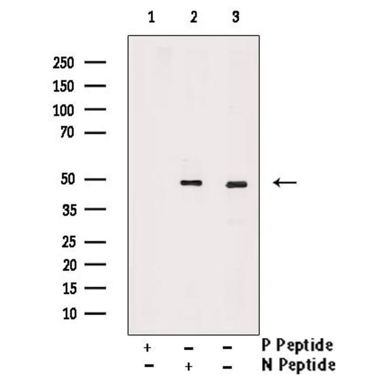 Validation Data - Anti-TAZ (phospho Ser66) Antibody (A256301)
