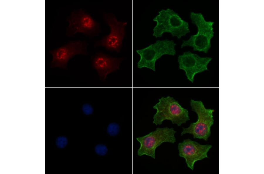Validation Data - Anti-TAZ (phospho Ser66) Antibody (A256301)