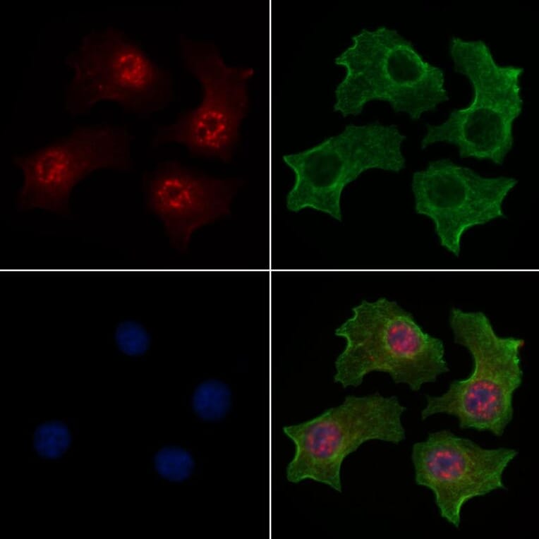 Validation Data - Anti-TAZ (phospho Ser66) Antibody (A256301)