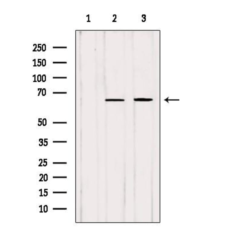 Western blots show p65 antibodies that passed the test of specificity