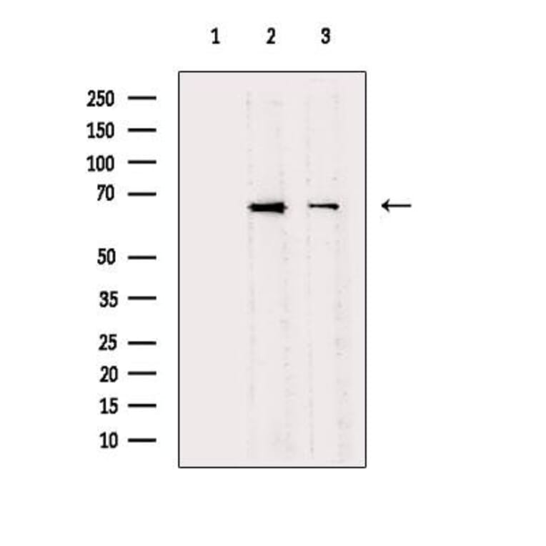 Studying the potential of upregulated PTGS2 and VEGF-C besides