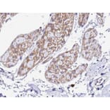 Validation Data - Anti-XBP1 Antibody (A256718)