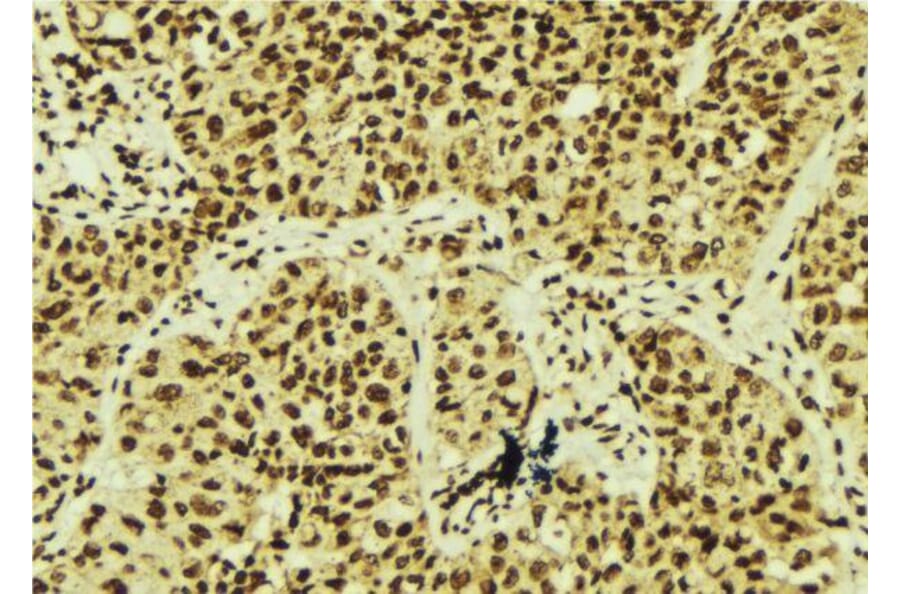 Validation Data - Anti-XBP1 Antibody (A256718)
