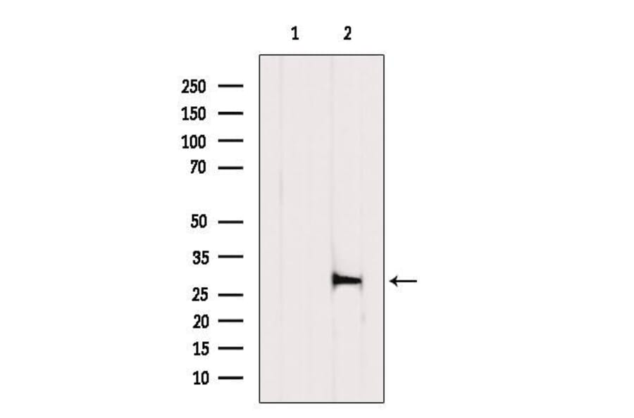Validation Data - Anti-XBP1 Antibody (A256718)