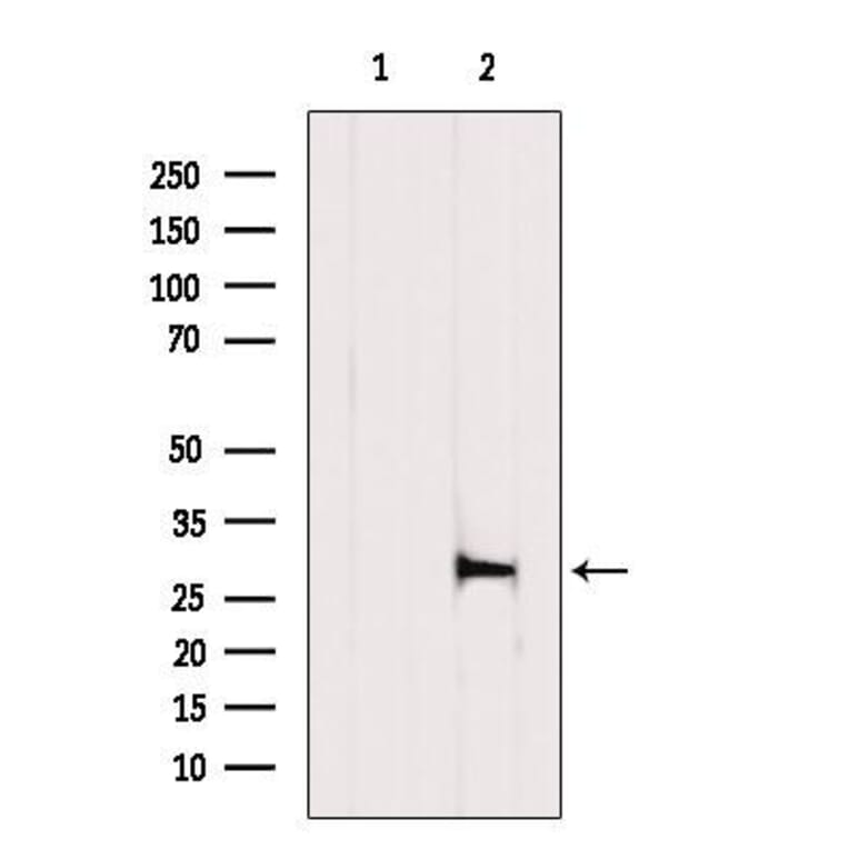 Validation Data - Anti-XBP1 Antibody (A256718)