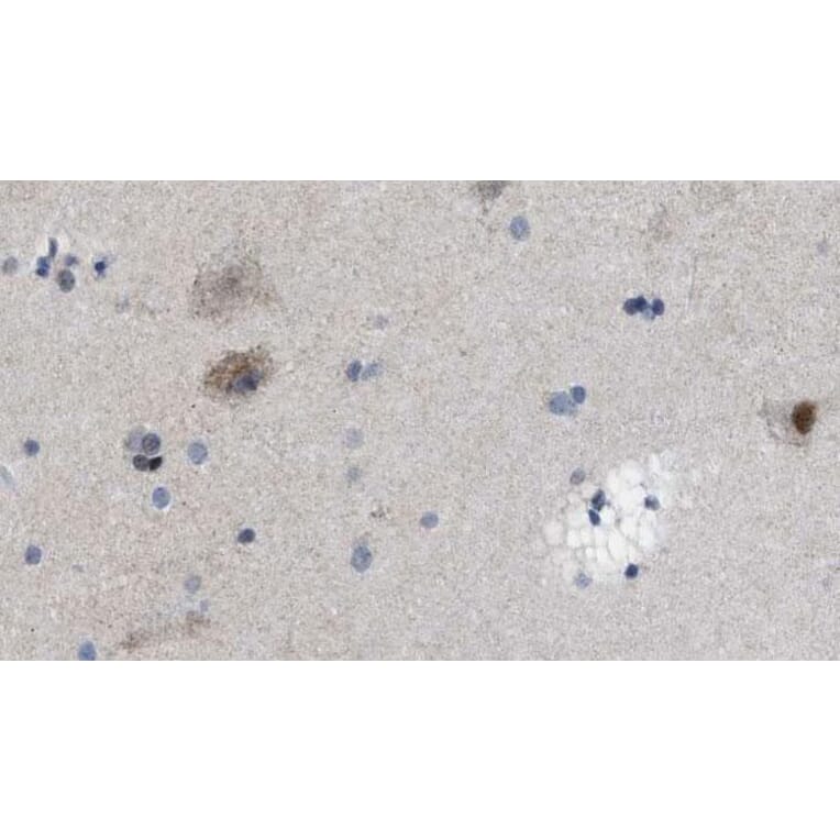 Rabbit polyclonal antibody to PGP9.5. (A257092) | Antibodies.com