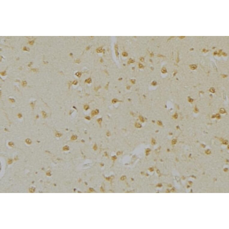 Rabbit polyclonal antibody to PGP9.5. (A257092) | Antibodies.com