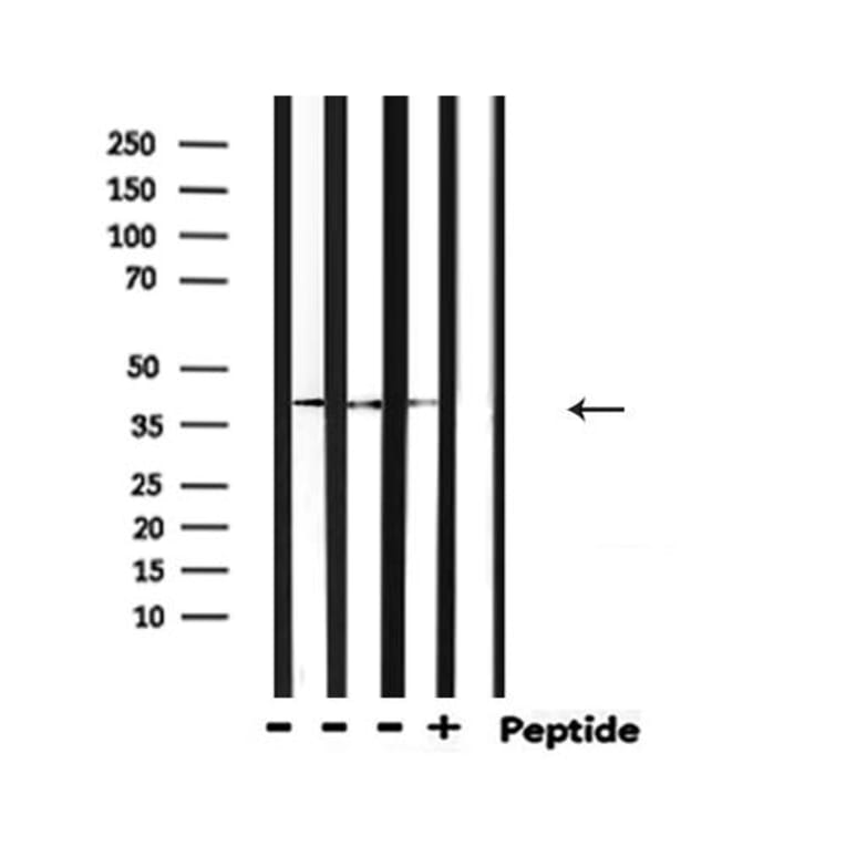 Effects of local perfusion of alpha-methyl-p-tyrosine (AMPT; 100 µM) on