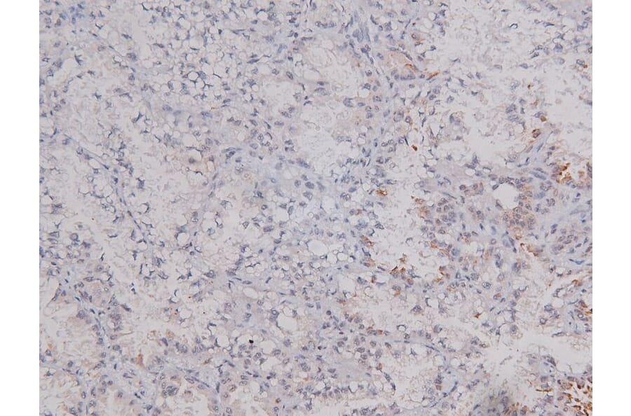 Validation Data - Anti-DNA-PK (phospho Ser2612) Antibody (A258913)