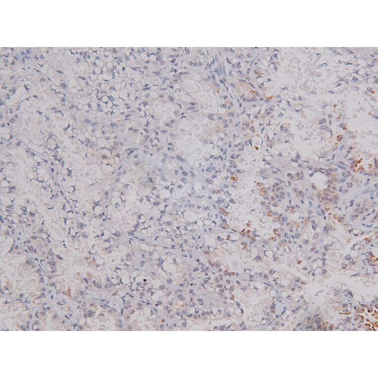 Validation Data - Anti-DNA-PK (phospho Ser2612) Antibody (A258913)