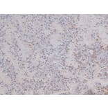 Validation Data - Anti-DNA-PK (phospho Ser2612) Antibody (A258913)