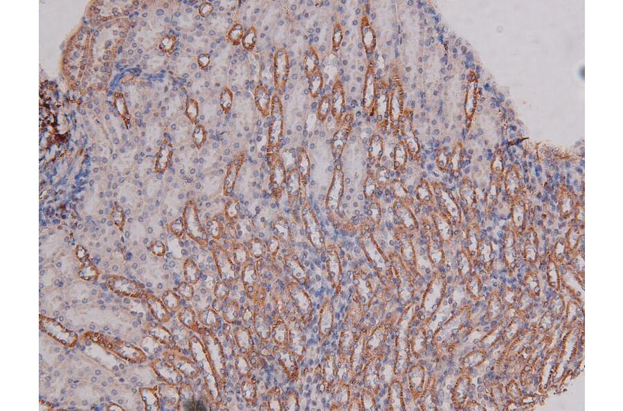 Validation Data - Anti-DNA-PK (phospho Ser2612) Antibody (A258913)