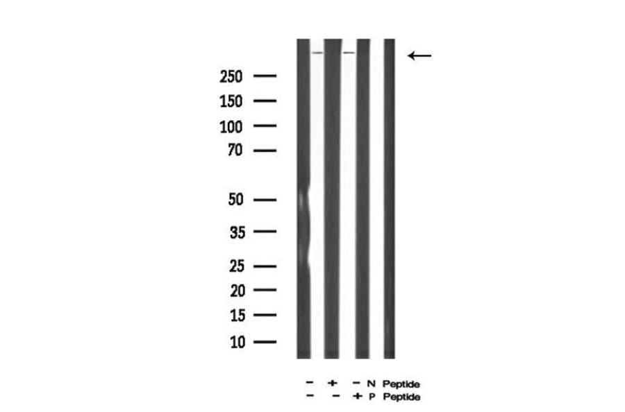 Validation Data - Anti-DNA-PK (phospho Ser2612) Antibody (A258913)