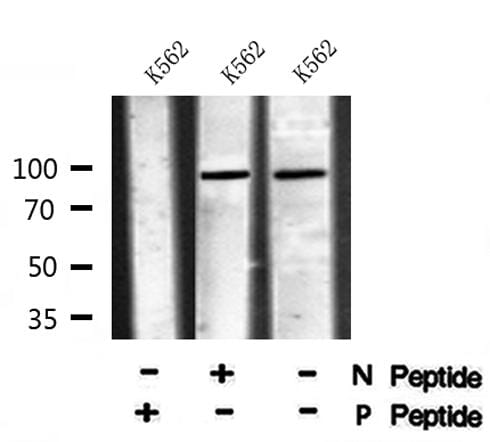 Rabbit polyclonal antibody to TGF beta Receptor III (phospho 