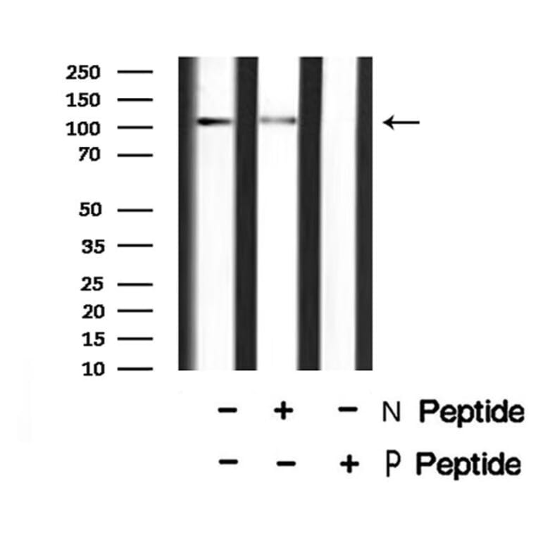 Validation Data - Anti-MYPT1 (phospho Ser668) + MYPT2 (phospho Ser618) Antibody (A259307)