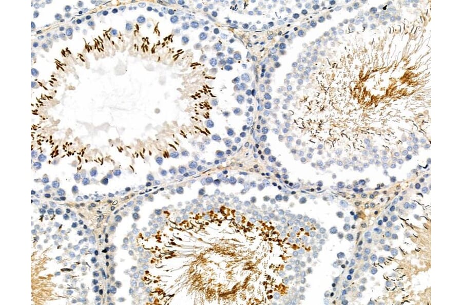 Validation Data - Anti-MYPT1 (phospho Ser668) + MYPT2 (phospho Ser618) Antibody (A259307)