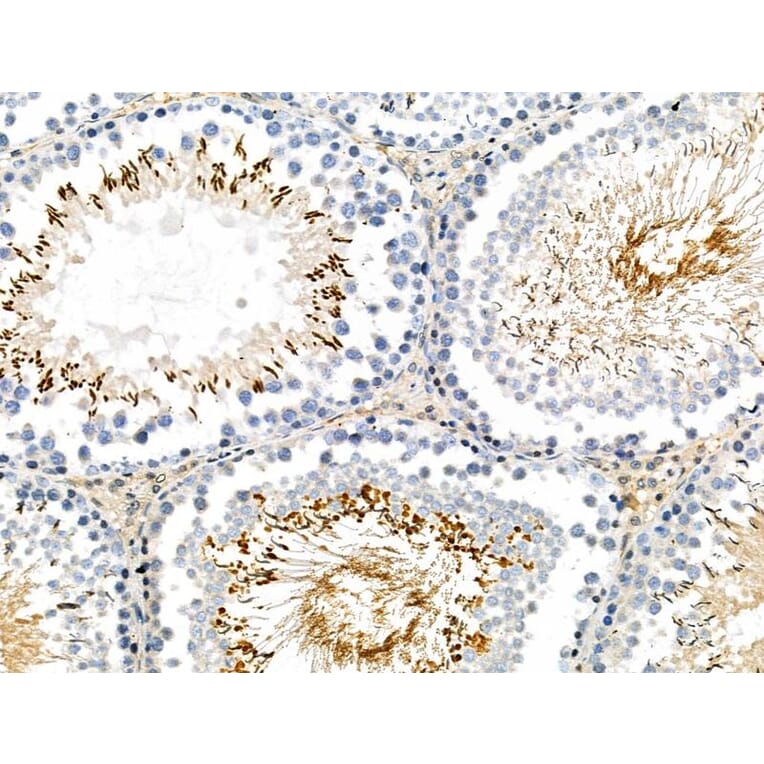 Validation Data - Anti-MYPT1 (phospho Ser668) + MYPT2 (phospho Ser618) Antibody (A259307)
