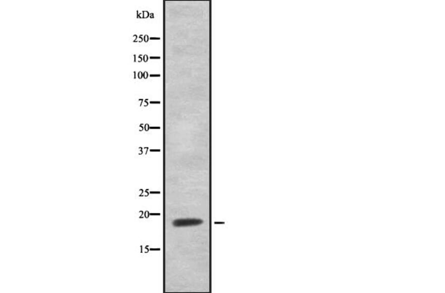 Validation Data - Anti-NHLH1 + NHLH2 Antibody (A259485)