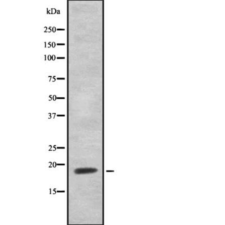 Validation Data - Anti-NHLH1 + NHLH2 Antibody (A259485)