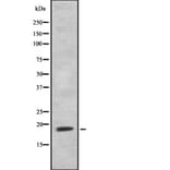 Validation Data - Anti-NHLH1 + NHLH2 Antibody (A259485)
