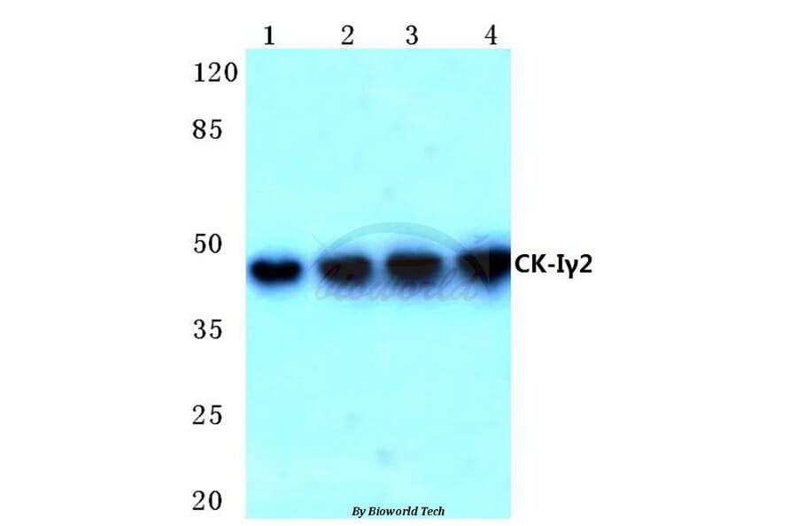 Anti-Casein Kinase Iγ2 (G7) Antibody from Bioworld Technology (BS2025) - Antibodies.com