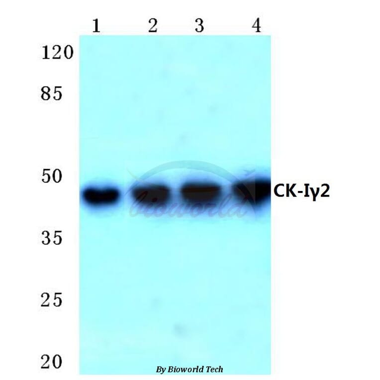 Anti-Casein Kinase Iγ2 (G7) Antibody from Bioworld Technology (BS2025) - Antibodies.com