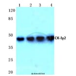 Anti-Casein Kinase Iγ2 (G7) Antibody from Bioworld Technology (BS2025) - Antibodies.com