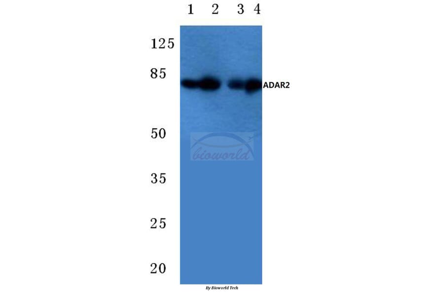 Anti-ADAR2 (R510) Antibody from Bioworld Technology (BS2026) - Antibodies.com
