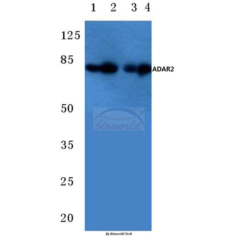 Anti-ADAR2 (R510) Antibody from Bioworld Technology (BS2026) - Antibodies.com