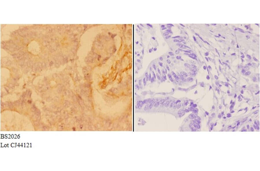 Anti-ADAR2 (R510) Antibody from Bioworld Technology (BS2026) - Antibodies.com