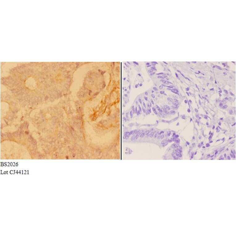 Anti-ADAR2 (R510) Antibody from Bioworld Technology (BS2026) - Antibodies.com