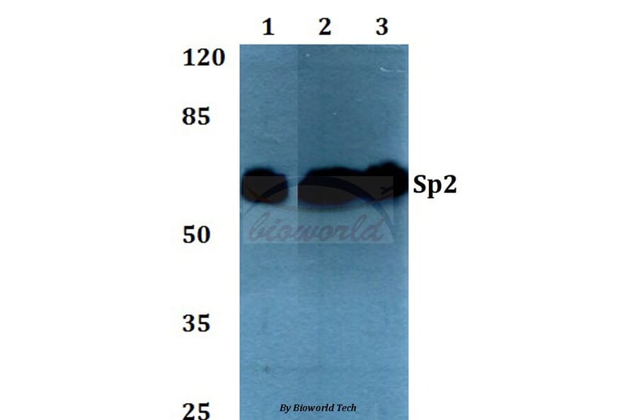 Anti-Sp2 (D512) Antibody from Bioworld Technology (BS2029) - Antibodies.com
