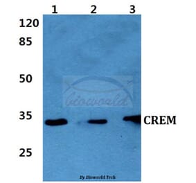 Anti-CREM (I106) Antibody from Bioworld Technology (BS2032) - Antibodies.com