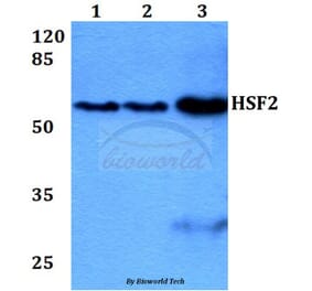 Anti-HSF2 (R432) Antibody from Bioworld Technology (BS2033) - Antibodies.com