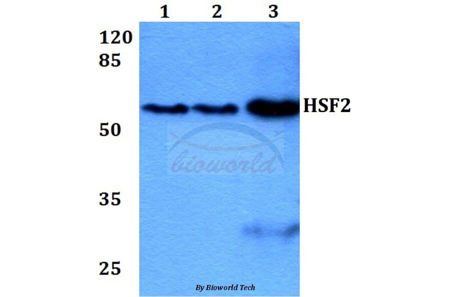 Anti-HSF2 (R432) Antibody from Bioworld Technology (BS2033) - Antibodies.com