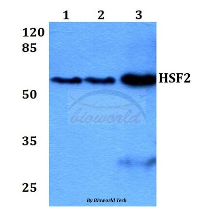 Anti-HSF2 (R432) Antibody from Bioworld Technology (BS2033) - Antibodies.com