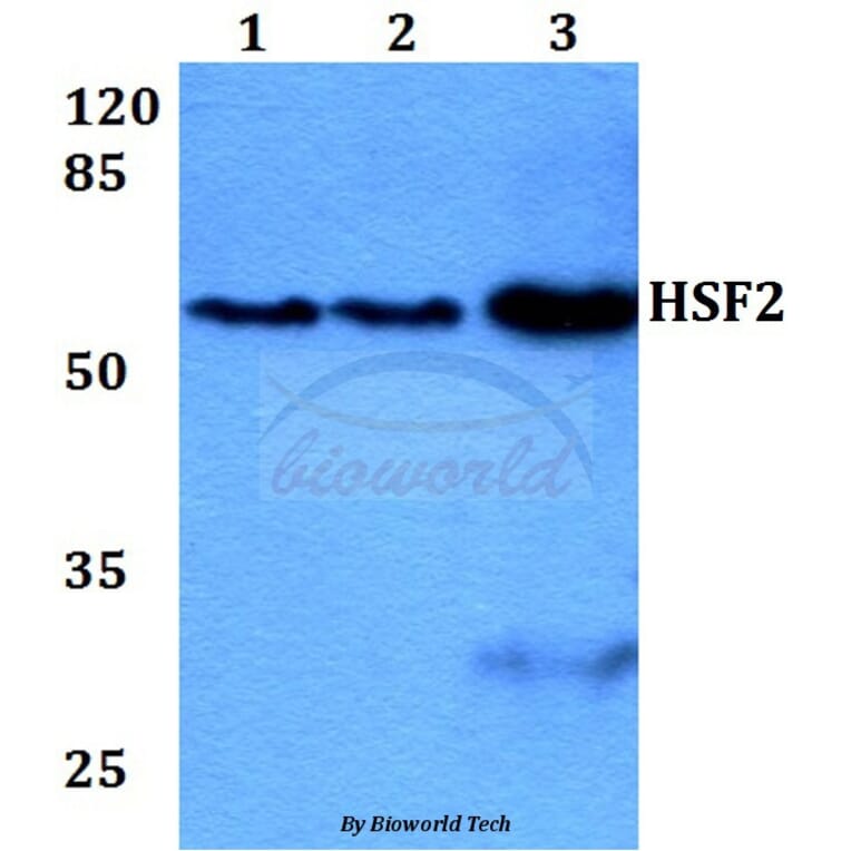 Anti-HSF2 (R432) Antibody from Bioworld Technology (BS2033) - Antibodies.com